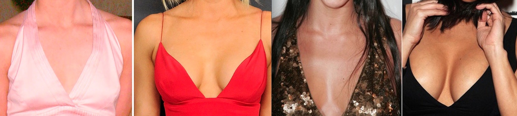 before and after celeb