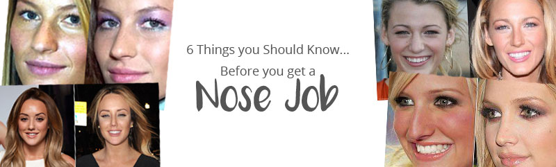 nose-job-banner
