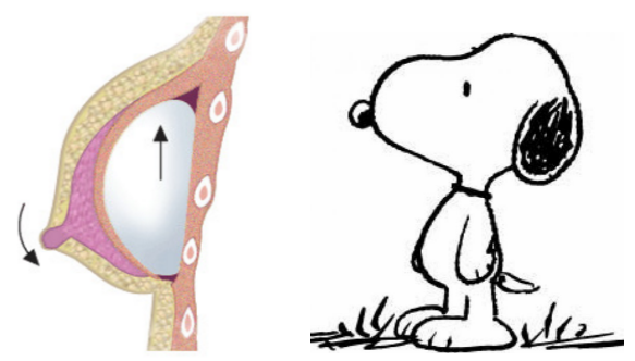 snoopy breast deformity The who sex pistols