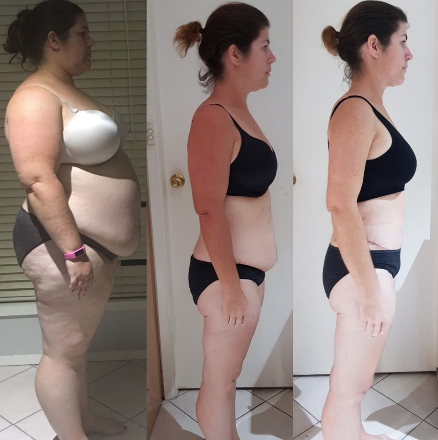 Dr Pornthep Creates Rochelle’s Dream Body!