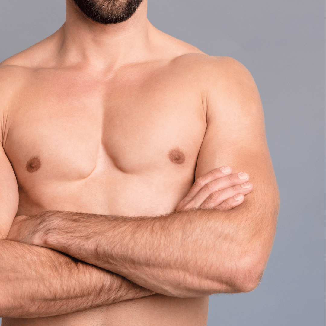 Man after Surgery to remove man boobs or Gynecomastia Surgery