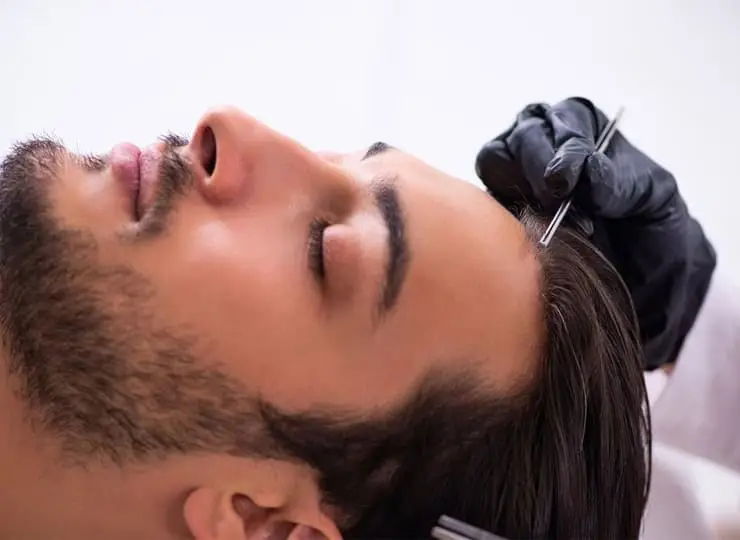 Long Hair FUE-DHI Thailand