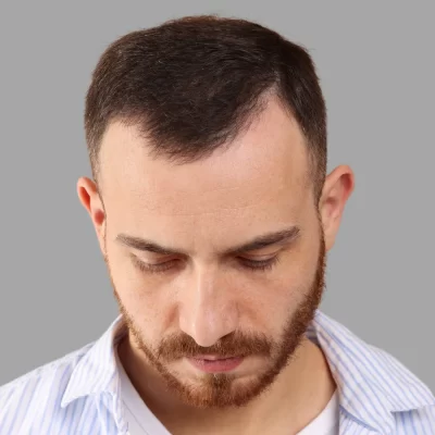 Image for choice number 2