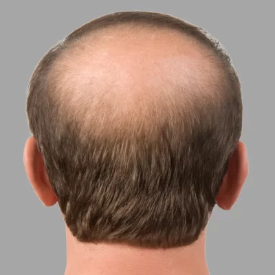 Image for choice number 6